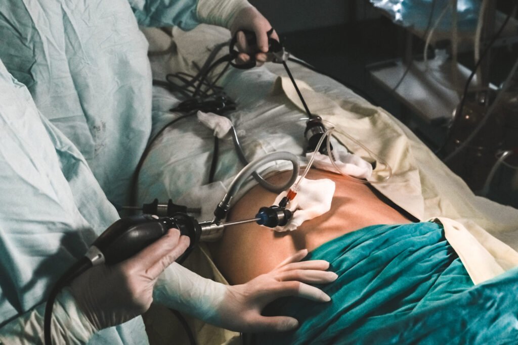 FeM-laparoscopic-nephrectomy-scaled