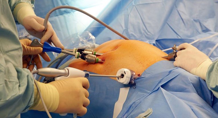 Gall-Bladder-Stone-banner