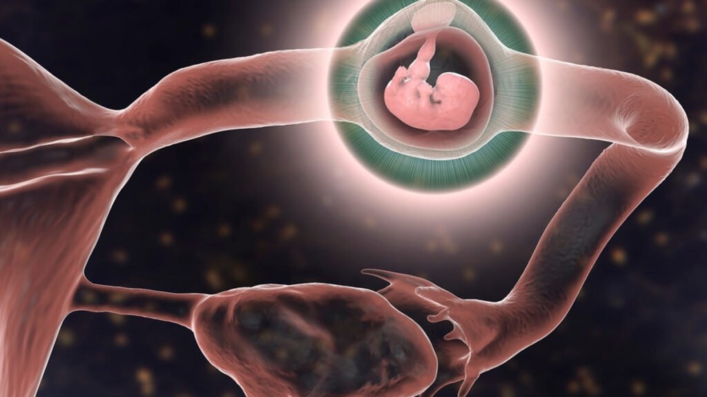 Main-ectopicpregnancyfrenchbaby