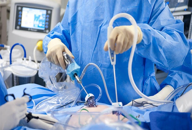 laparoscopic-myomectomy